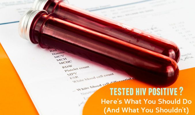 Hiv Aids Testing Centers