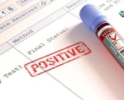 Free HIV Testing Near Me