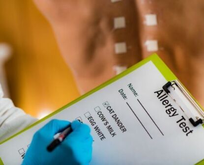 Allergy Screening Test