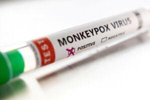 monkeypox