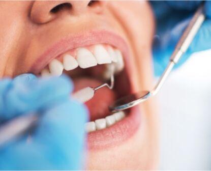 Oral Hygiene